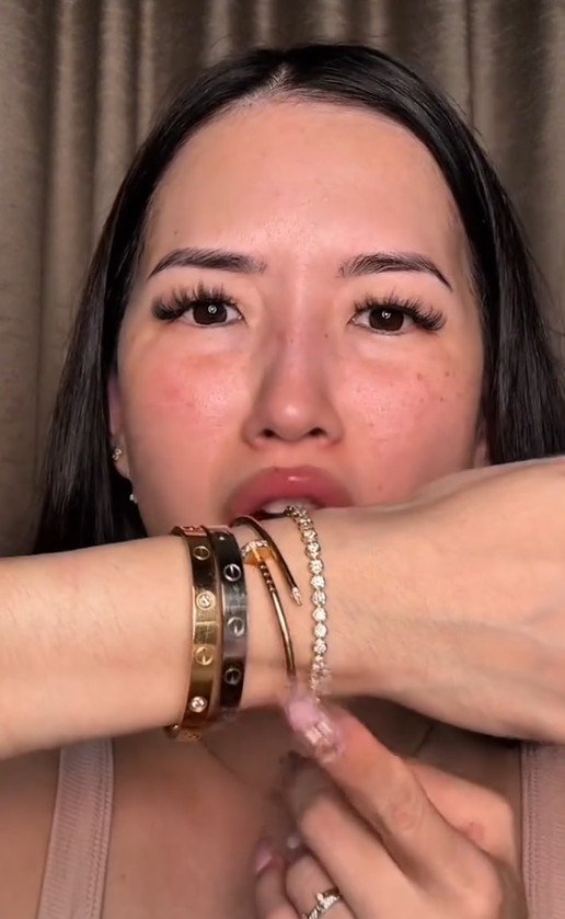 Cận cảnh vết rỉ sét trên motif vòng tay Van Cleef vàng 18K