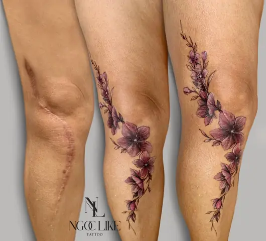 Vết Sẹo Đau Đớn Hơn Khi Bị Bạo Hành