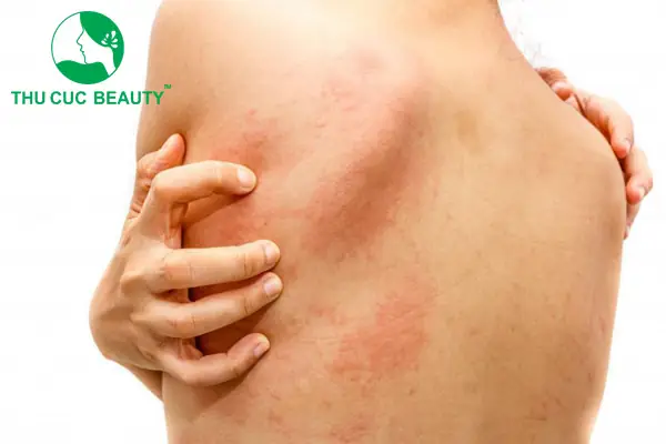 Trước Khi Thực Hiện Trước Khi Thực Hiện